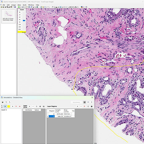Leica Aperio ImageScope software showing a prostate H&E slide