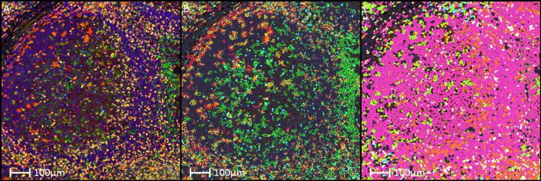 Human tonsil germinal center stained for Dapi, GATA3, CD3, CD4, CD8, TRBC1 and CD163