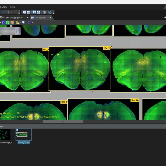 OlyVIA interface showing step sections of adult mouse brain.