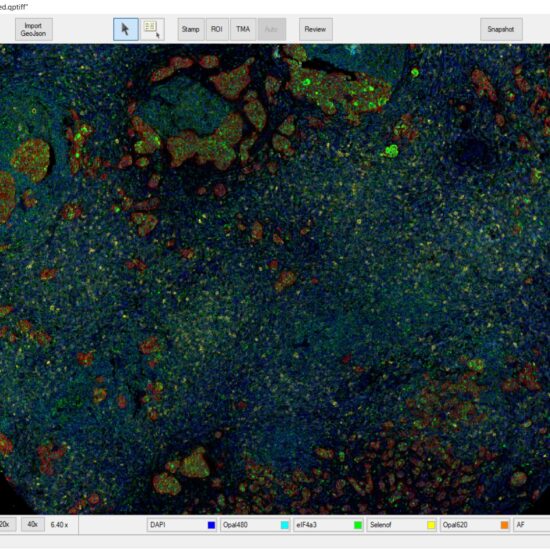 Phenochart application showing multiplex IF image