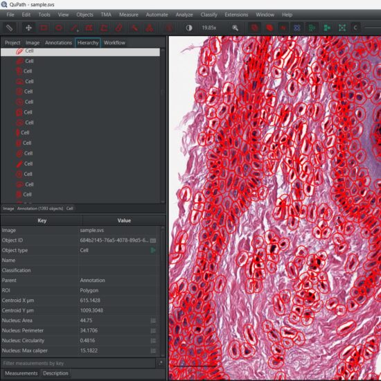 Image of QuPath software showing cell segmentation.