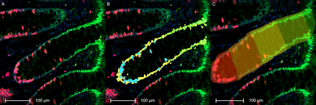 Human colon crypts stained for Ki67 and p21 showing zones for distance to the base of the crypt.