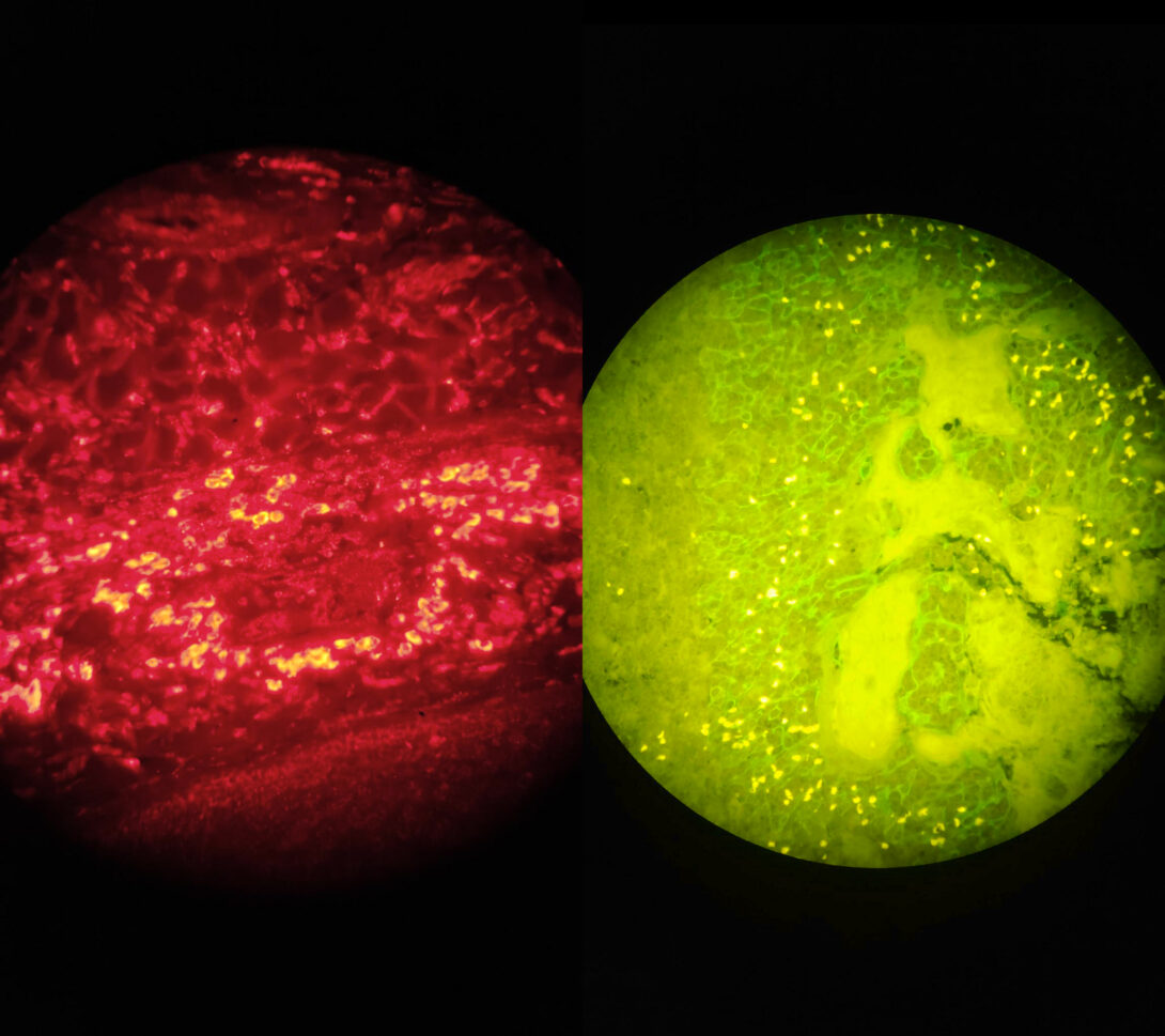 Ocular view of Opal 520 and Opal 620 as seen on the Vectra 3 microscope.